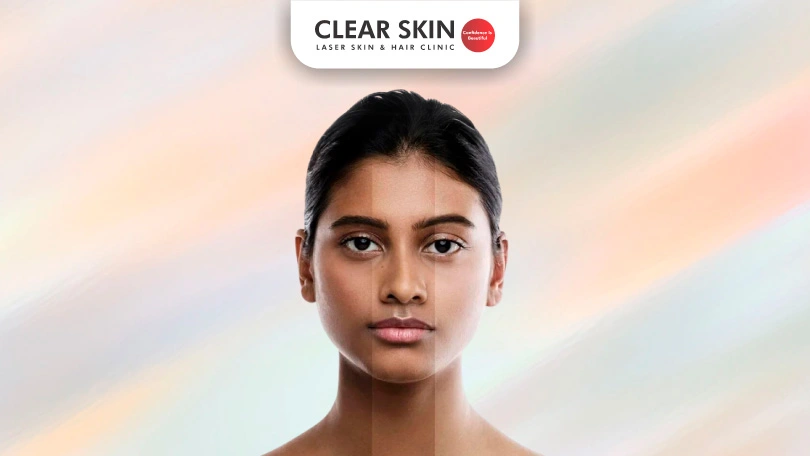 Unraveling Melanin: The Skin's Own Pigment Explained